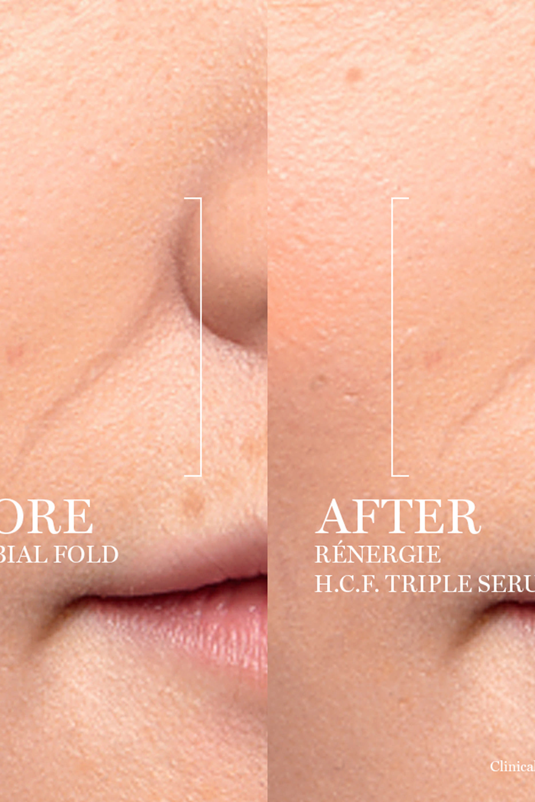 Renergie H.C.F. Triple Serum