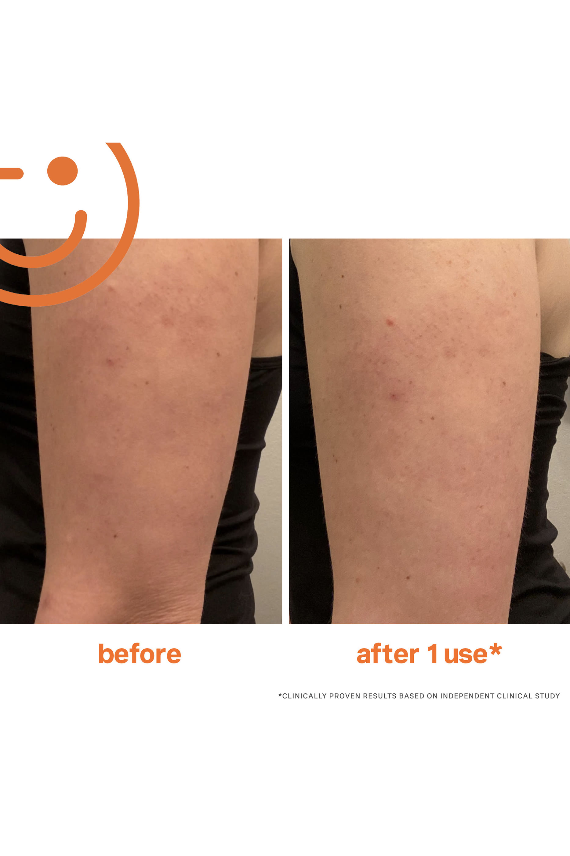 ExfoliKate&trade; Resurfacing Body Scrub