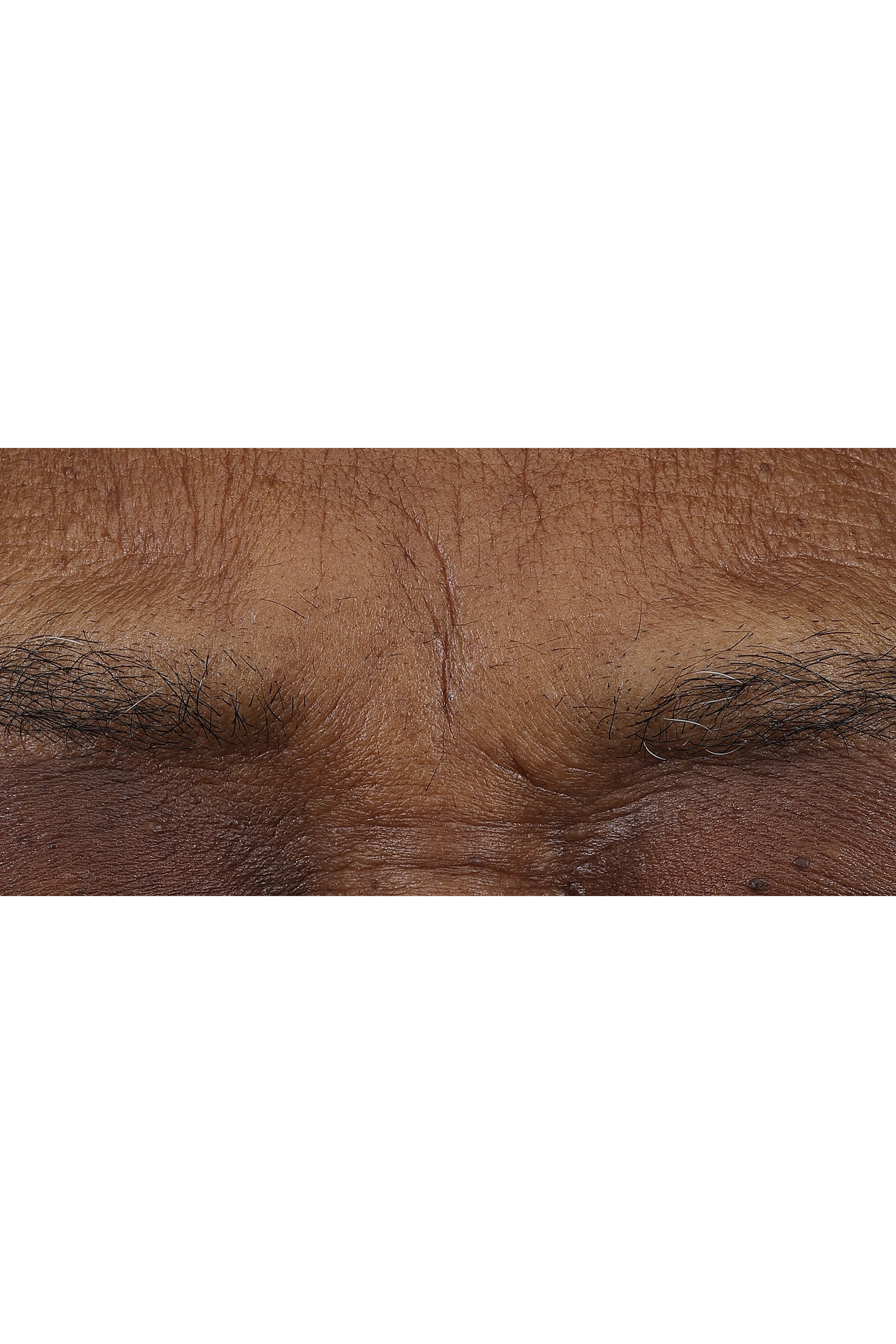 Smart Clinical Repair&trade; AM/PM Retinoid Balm