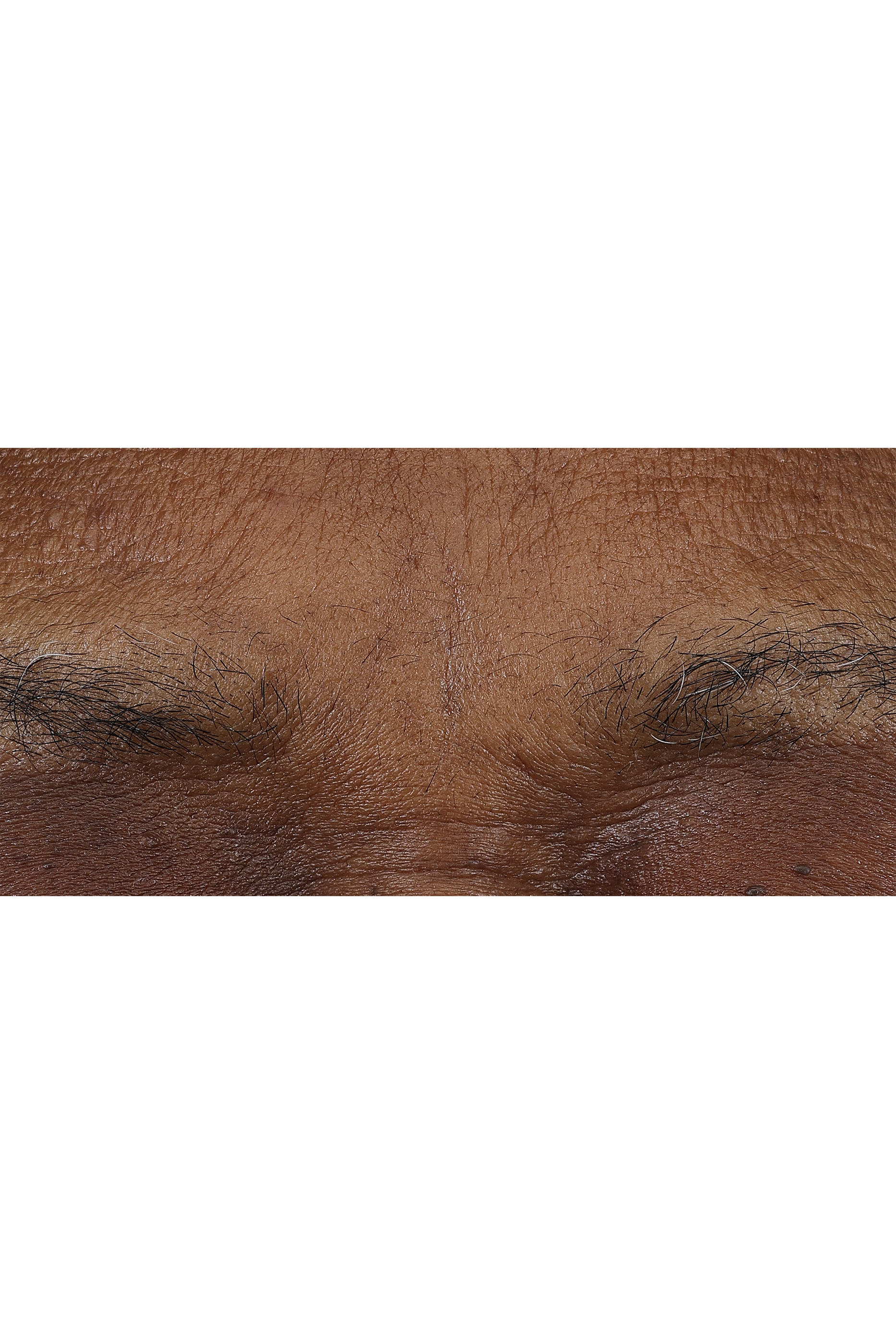 Smart Clinical Repair&trade; AM/PM Retinoid Balm