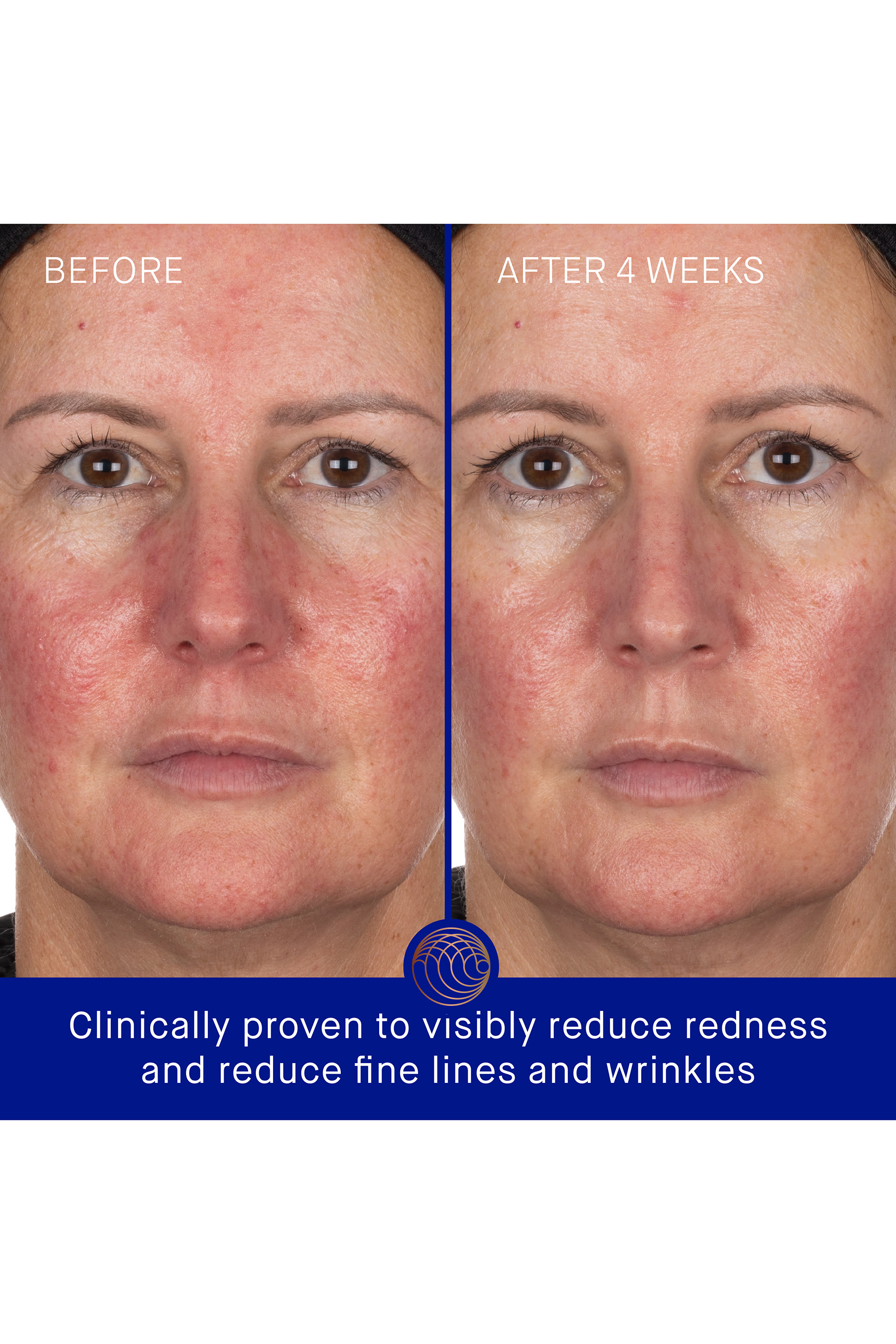 Hydrogel Face Mask (6 Pack)