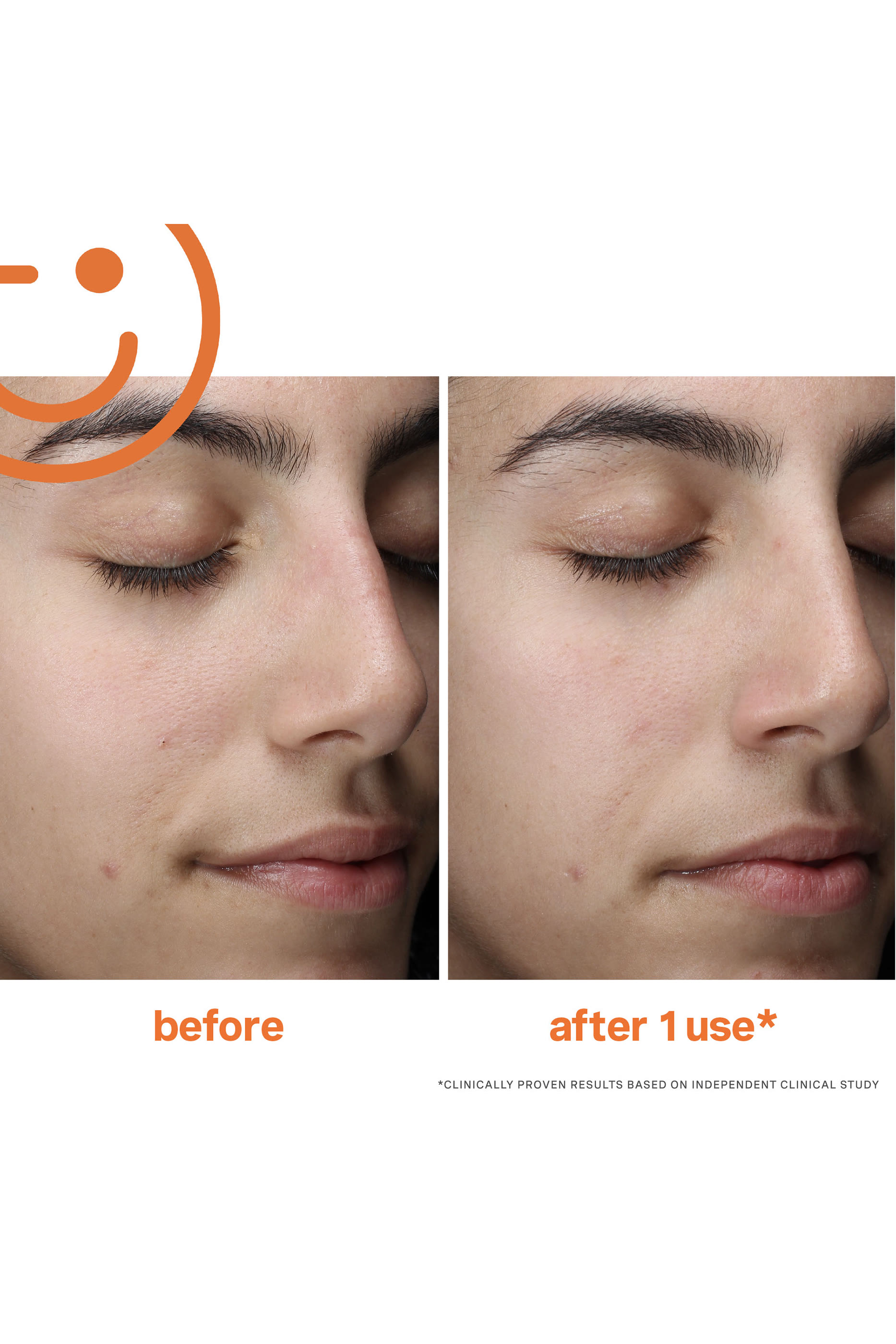 ExfoliKate&reg; Cleanser Daily Foaming Wash