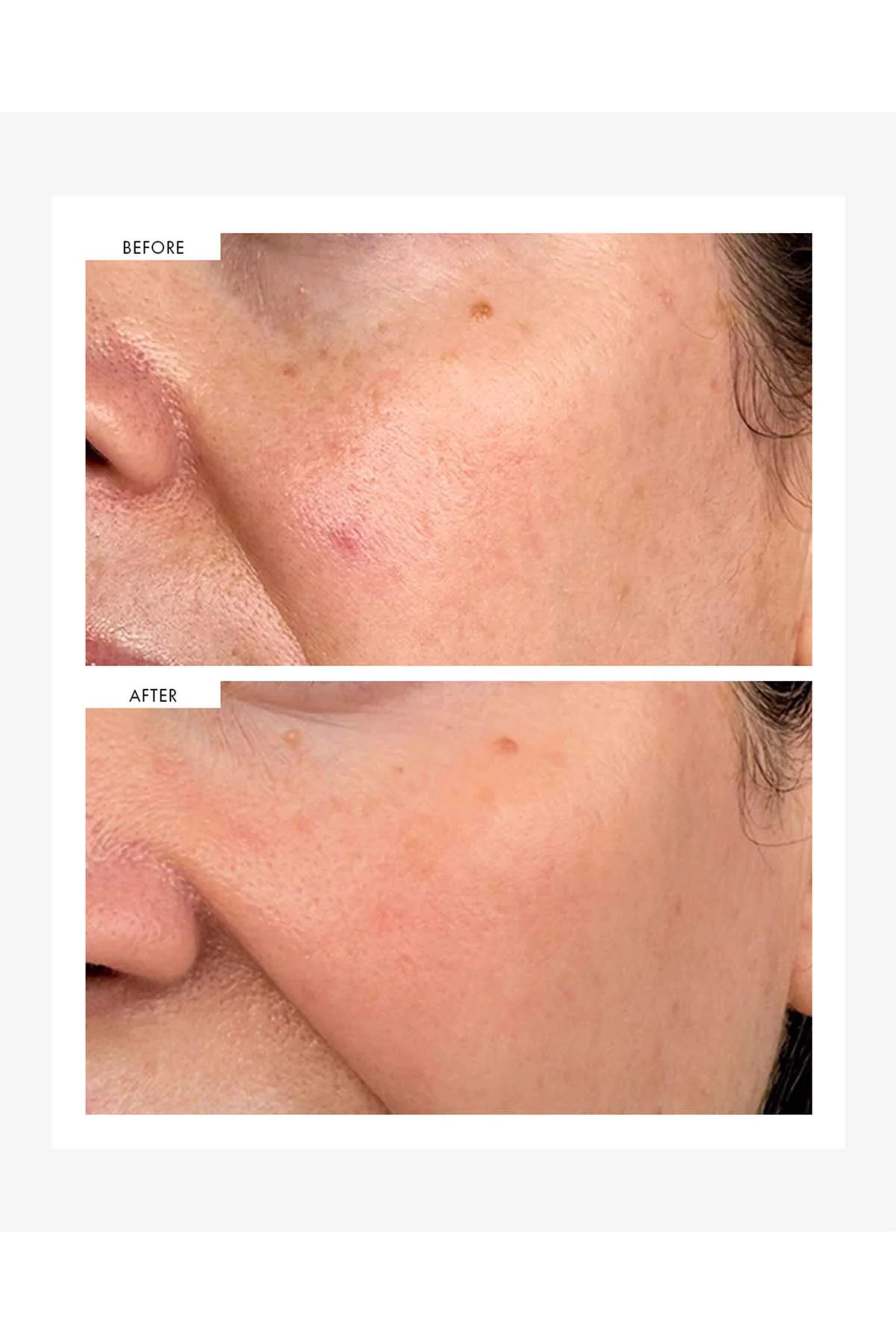 Dark Spot Correcting Serum
