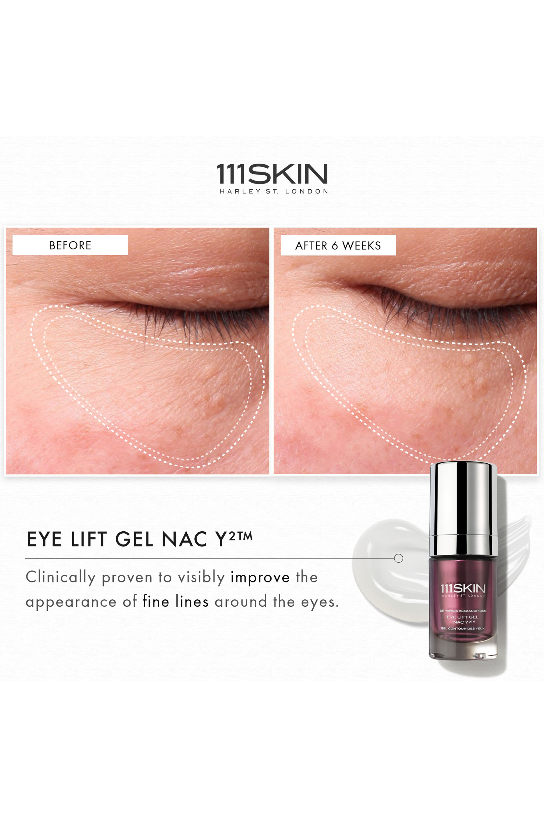 Eye Lift Gel NAC Y2