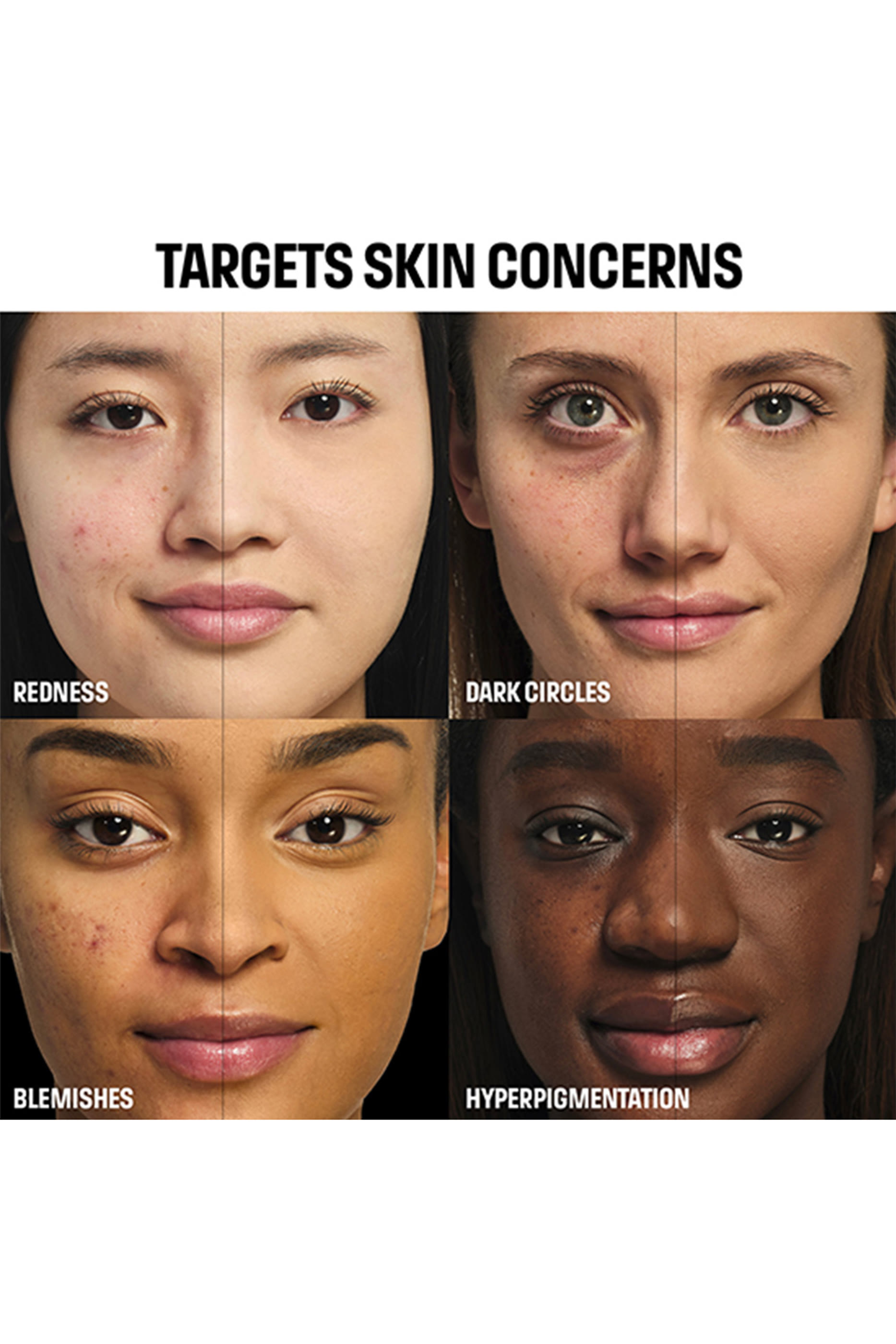 HD Skin Full Cover Conceale