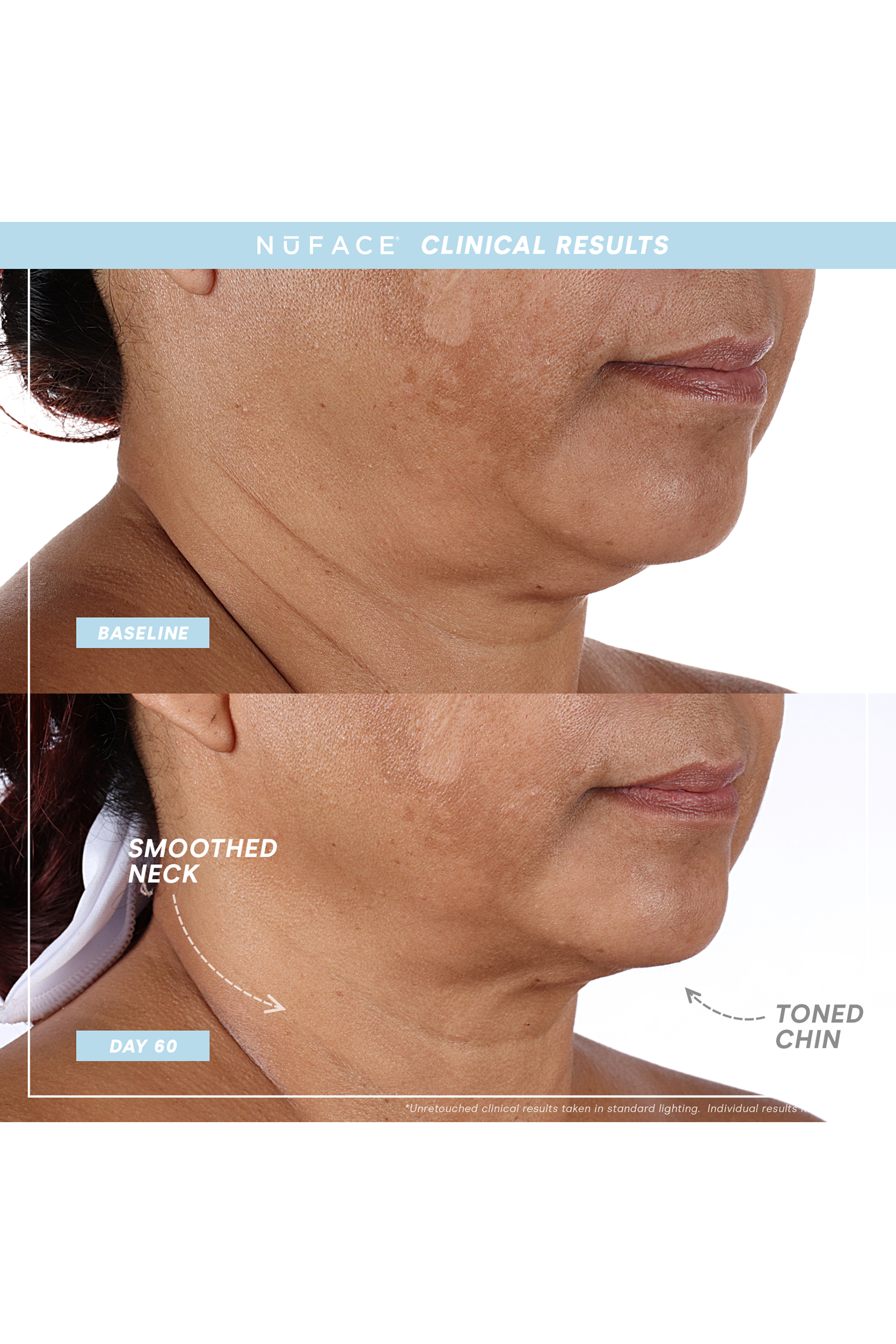 TRINITY + PRO Starter Kit