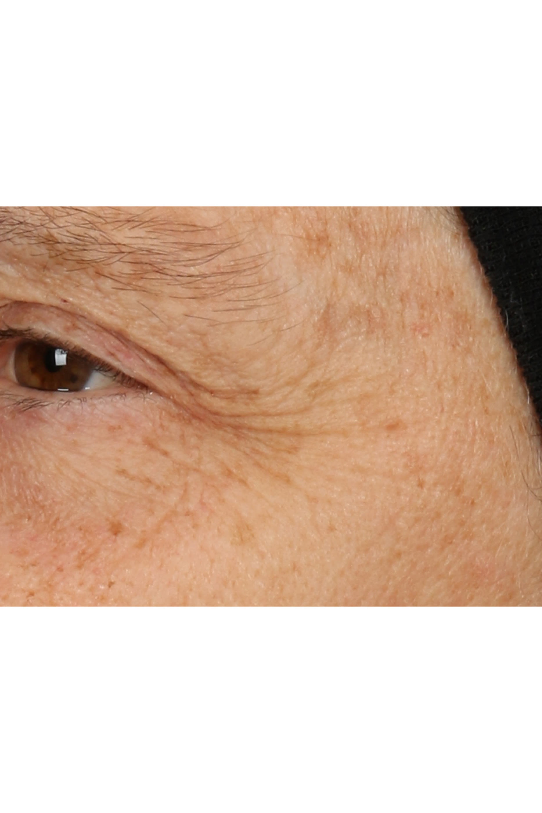 Smart Clinical Repair&trade; Overnight Recovery Cream + Mask